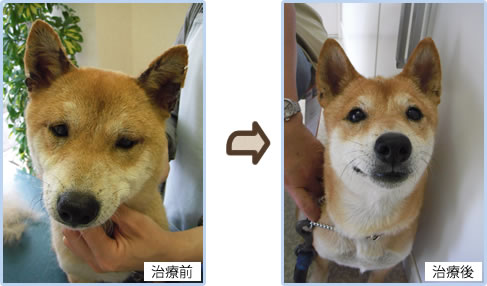感染症、昆虫刺咬性過敏症、治療前後写真