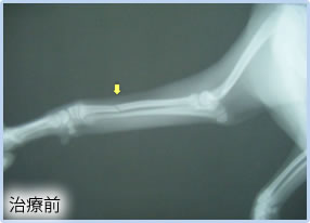 外科手術；外固定；手術前