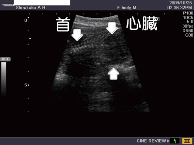 妊娠7週写真