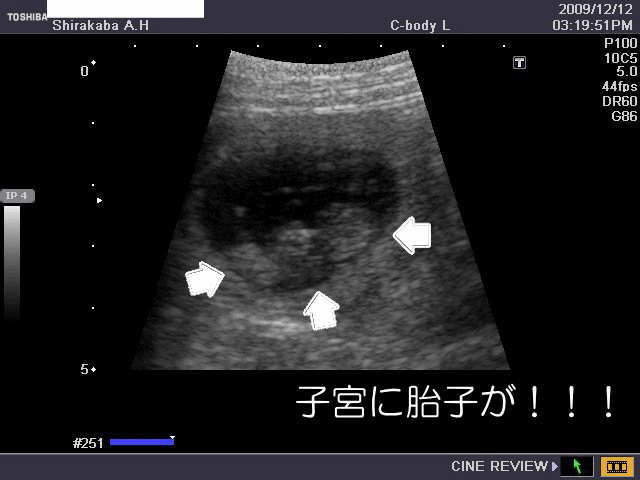 妊娠中の写真